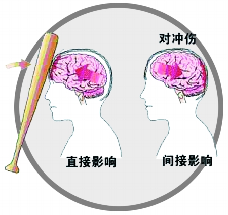 头部创伤的家庭急救处理与预防措施